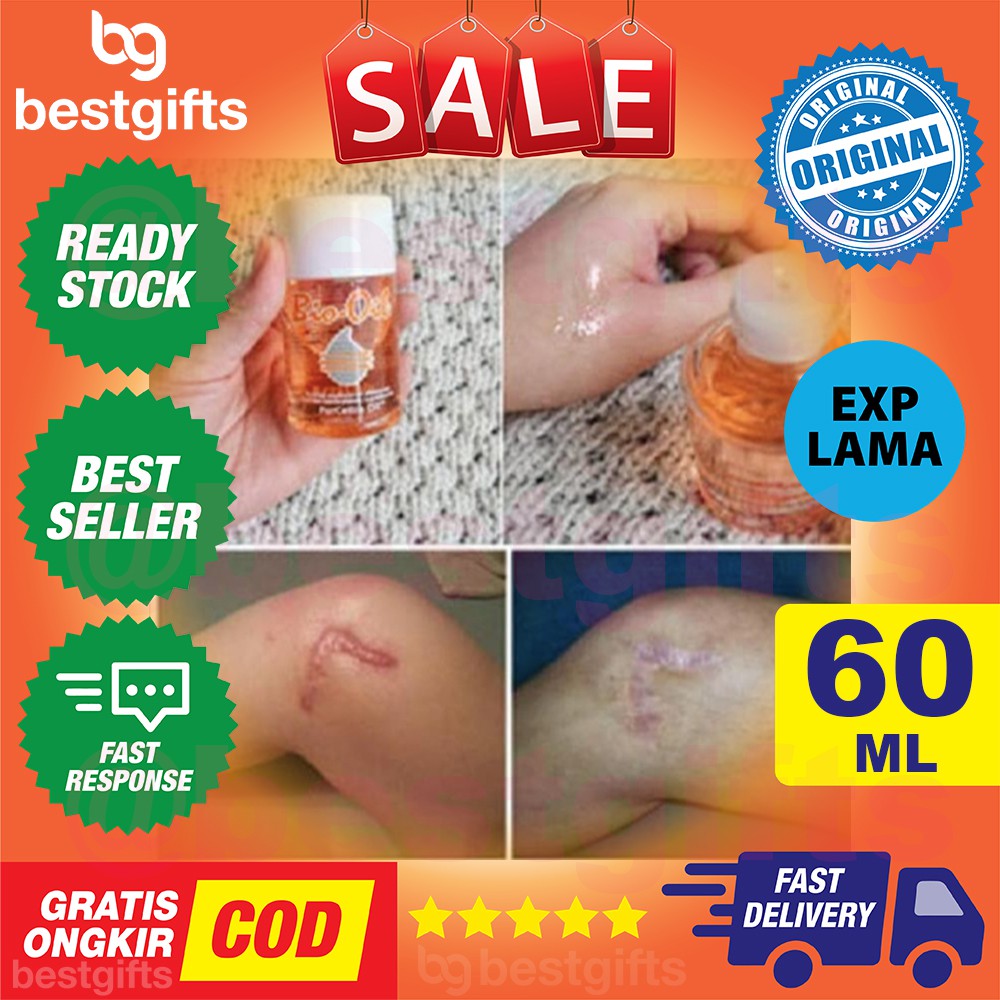 BIO OIL 60 ML 60ML BIOOIL PENGHILANG BEKAS LUKA PASCA HAMIL SCAR STRETCH MARK SELULIT STREACHMARK