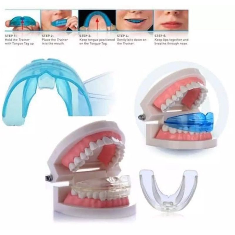 ORTHODENTIC RETAINER TEETH TRAINER ALIGMENT - BEHEL GIGI - MERAPIHKAN GIGI