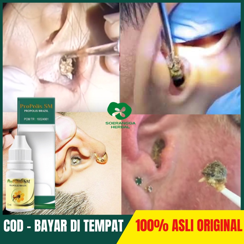 Obat Tetes Telinga Kotoran Keras, Penghilang Kotoran Telinga Anak, Obat Telinga Gatal, Obat Telinga 