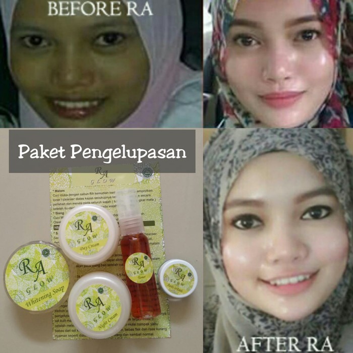 RA GLOW (PAKET PENGELUPASAN) /CREAM PEMUTIH WAJAH RACIKAN DOKTER -kec04