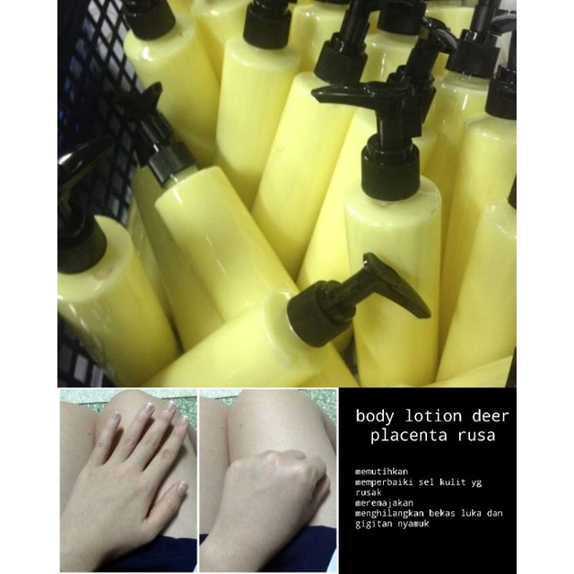body lotion placenta