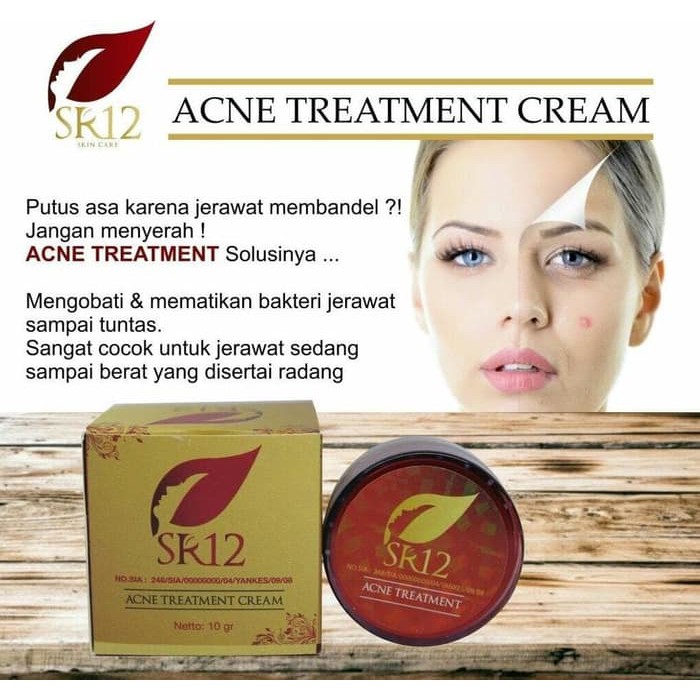 Sr12 Acne Treatment Cream - Perawatan Jerawat Untuk Muka Wajah Diskon