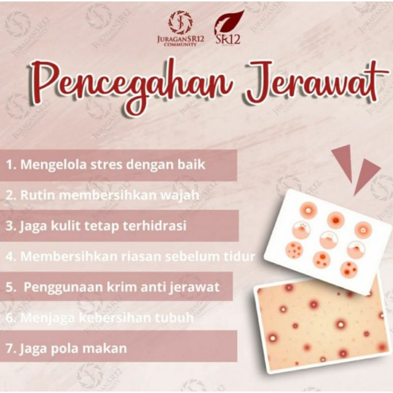 ACNE TOTOL SR12 SKINCARE BPOM HERBAL SR 12 Cream Krim Mengobati Mencegah menghilangkan Jerawat Batu