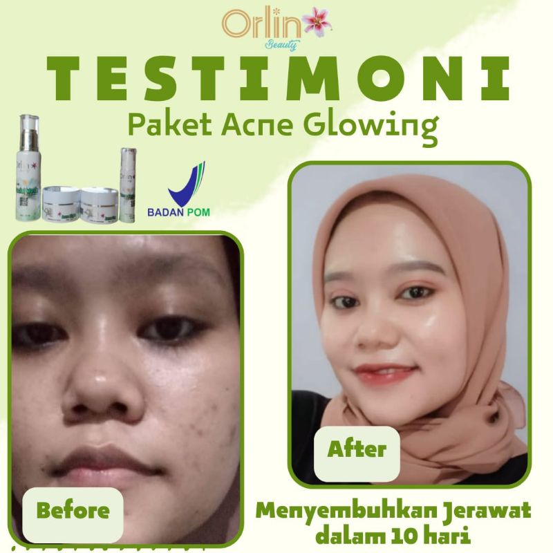 ( FREE HADIAH )ORLIN BEAUTY / ORLIN BEAUTY SKINCARE / ORLIN SKINCARE / PUTIH GLOWING 10HARI