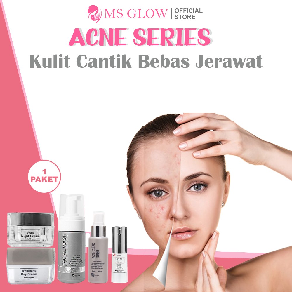 MS Glow Paket Wajah Acne Series free bonus pouch totebag Original Official Store 1