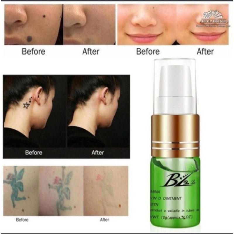 VITAMIN/AFTERCARE SETELAH SULAM/DARK SPOT REMOVAL