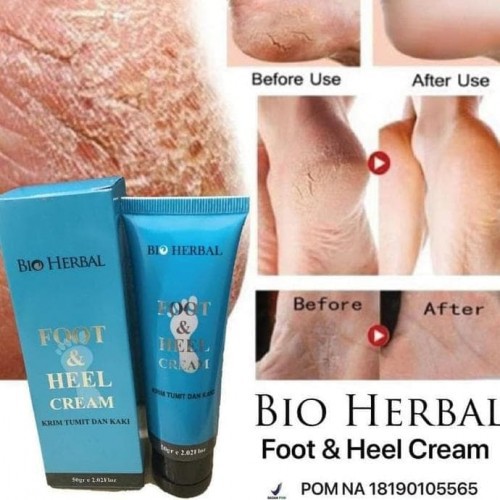 Obat Cream Tumit Pecah dan Kering Kaki Pecah2 Pecah Pecah Penghalus Kapalan Ampuh Tumitku Bio Herbal Original