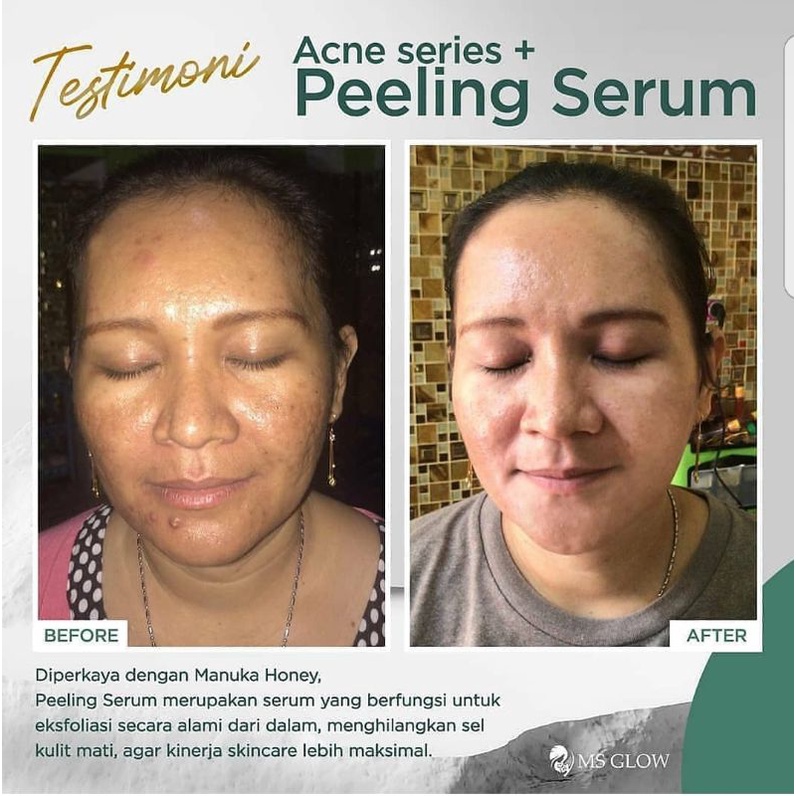 PEELING SERUM 10 ML MS GLOW BARKODE BPOM.