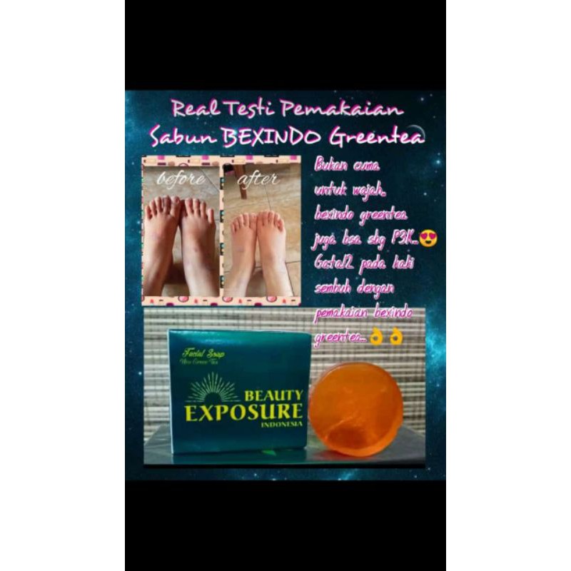sabun bexindo ori lulus badan BPOM