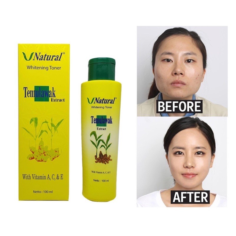 TEMULAWAK V NATURAL WHITENING TONER 100ml