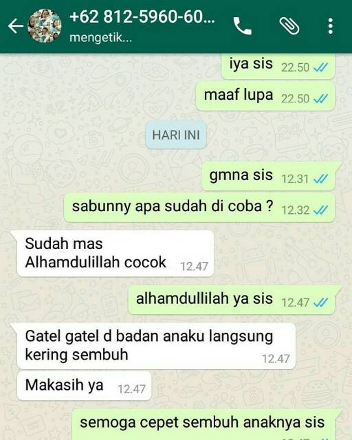 Sabun belerang obat kulit gatal 100% manjur BPOM