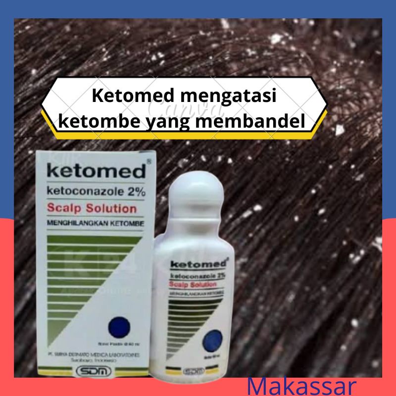 KETOMED  2%  Shampo 60 ml mengatasi ketombe &amp; rambut rontok