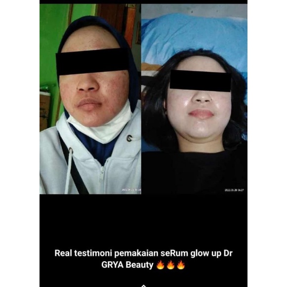 PROMO cream pemutih grya beauty