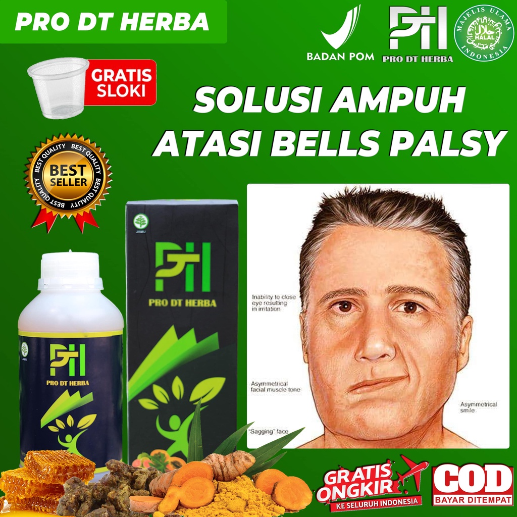 Jual Obat Bells Palsy Herbal Ampuh Stroke Berat Paling Ampuh Stroke