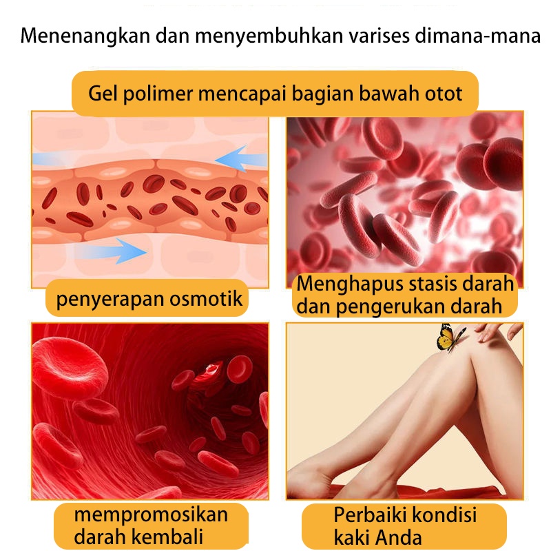 obat varises 50g Varises Obat Varises Paling Ampuh Pijat kaki untuk menghilangkan rasa sakit / mengeruk meridian / perawatan relaksasi vena dan krim perbaikan Bengkak Benjolan Vaskulitis Flebitis Pengobatan Vaskulitis