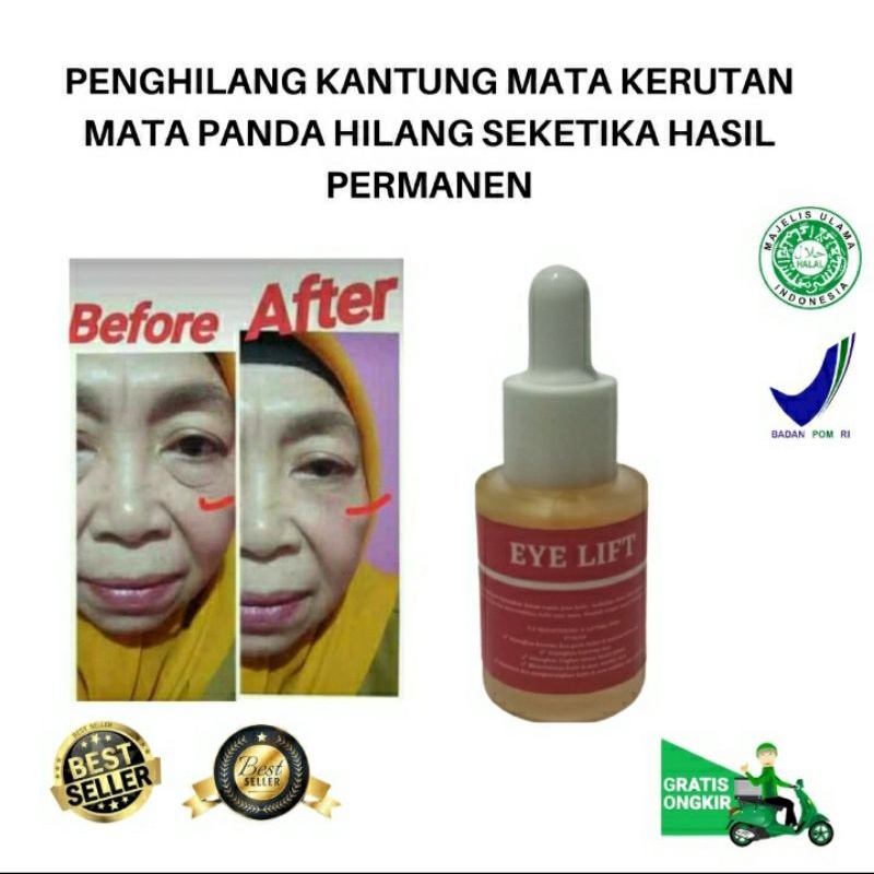 TERLARIS(EYELIFT) CUKUP DIOLES 3X MENGATASI,MENYAMARKAN KANTUNG MATA KERUTAN MATA PANDA  HILANG PERM