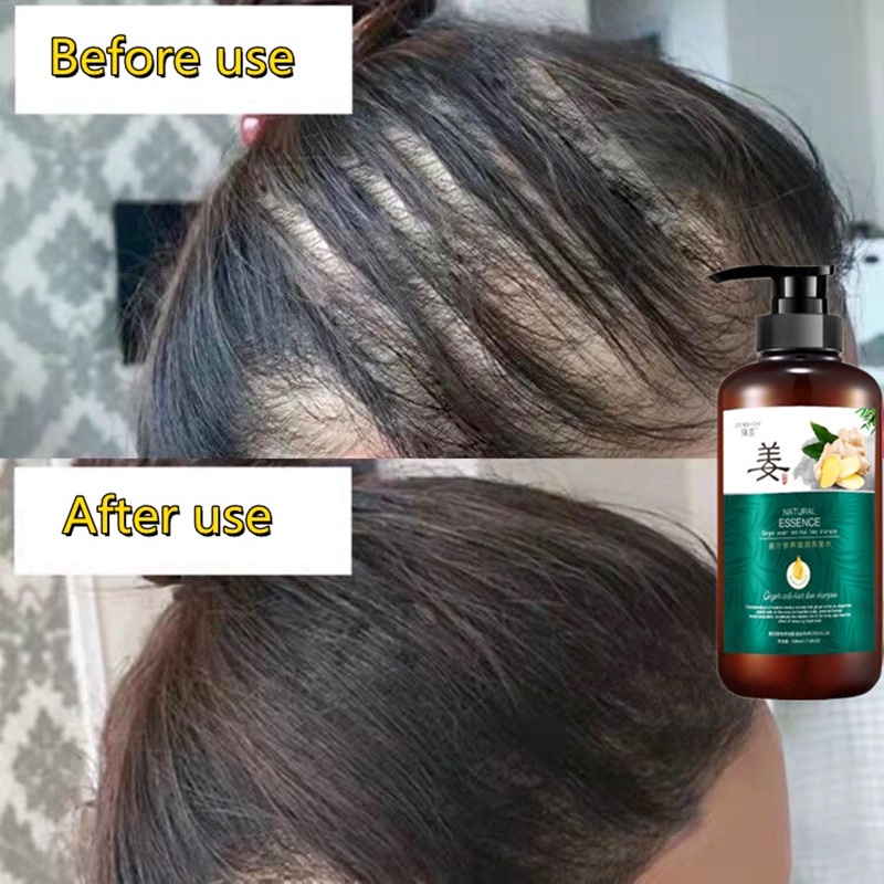 shampo penumbuh rambut cepat serum rambut rontok ginger shampoo botak rontok penumbuh rambut perawatan hair care treatment Anti rambut rontok