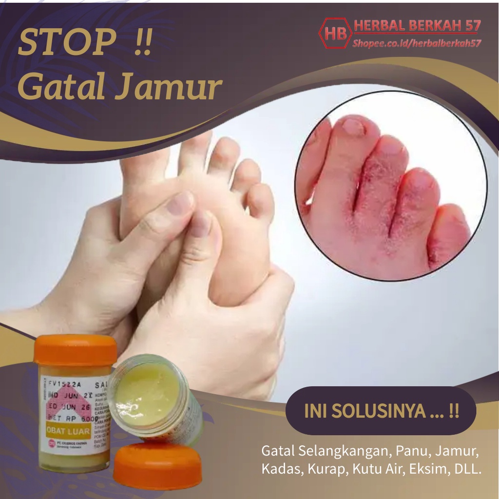 Obat Salep Gatal Paling Ampuh Gatel Kulit Panu Kadas Jamur Eksim Kutu Air Jerawat Selangkangan-8