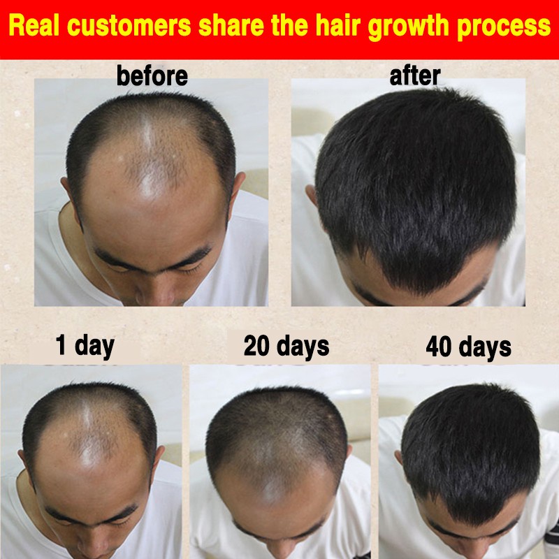 Shampo herbal jahe profesional anti-rambut rontok/gatal/ketombe minyak kontrol menyegarkan 400ml