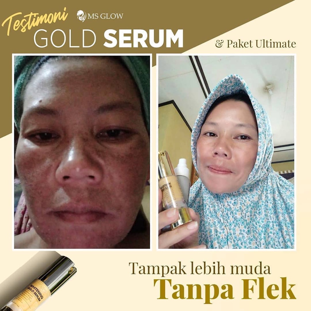 Ms Glow Whitening Gold Serum Ms Glow Original 100% Serum Antiflek Dan Noda Hitam 10X Lipat Mencerahkan Ms Glow