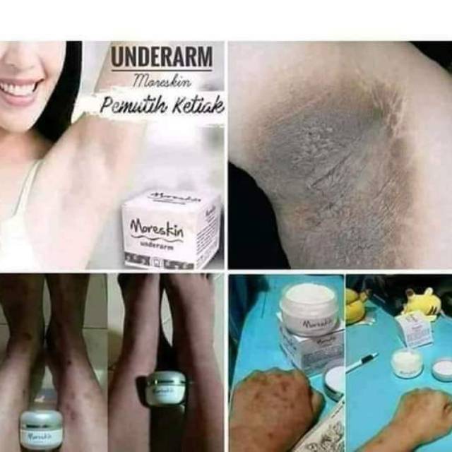 Moreskin underarm