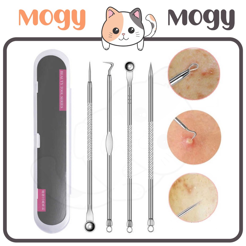 MOGYMOGY HL0140 Alat Pencet Jerawat Komedo Set 4 In 1 Pinset Jerawat Pembersih Blackhead