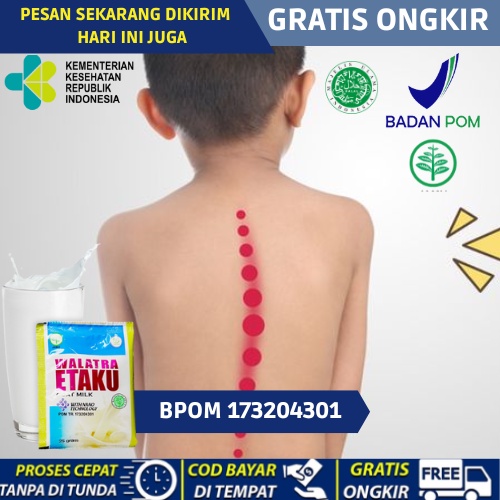 susu penguat tulang anak, susu kambing untuk kesehatn tulang dan gigi pada anak, susu untuk menjaga 