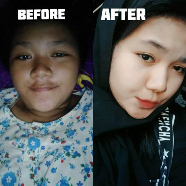 Crim pemutih wajah glowing