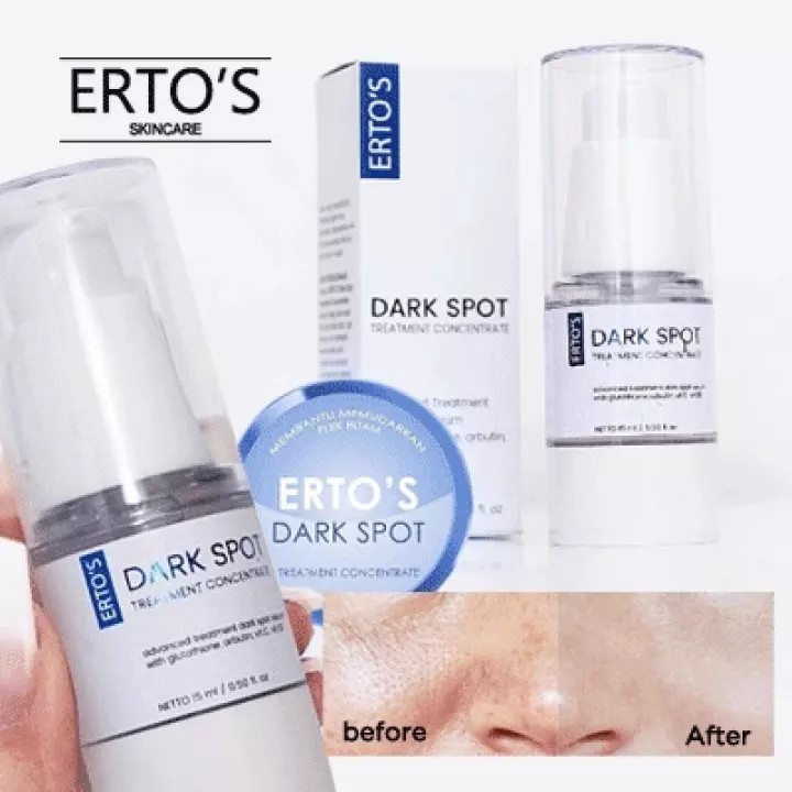 [ORI] Dark Spot Treatment Concentrate | Serum Whitening Agent Membasmi Flek Hitam di Wajah