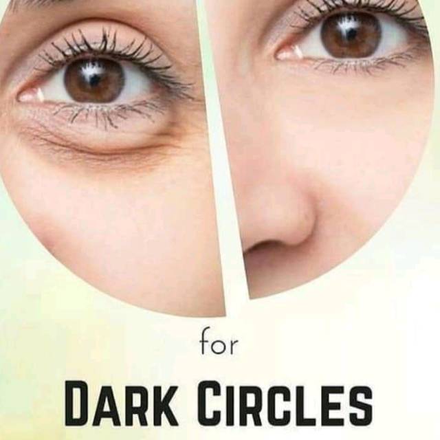 Penghilang Kantung Mata Ampuh