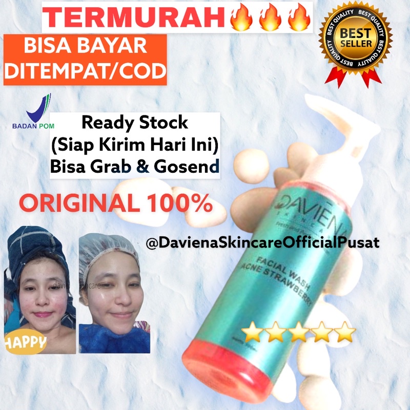 TERLARIS FACIAL WASH ACNE SERIES | DAVIENA | DAVIENA SKINCARE | DAVIENASKINCARE Davina ASLI 100% Sab