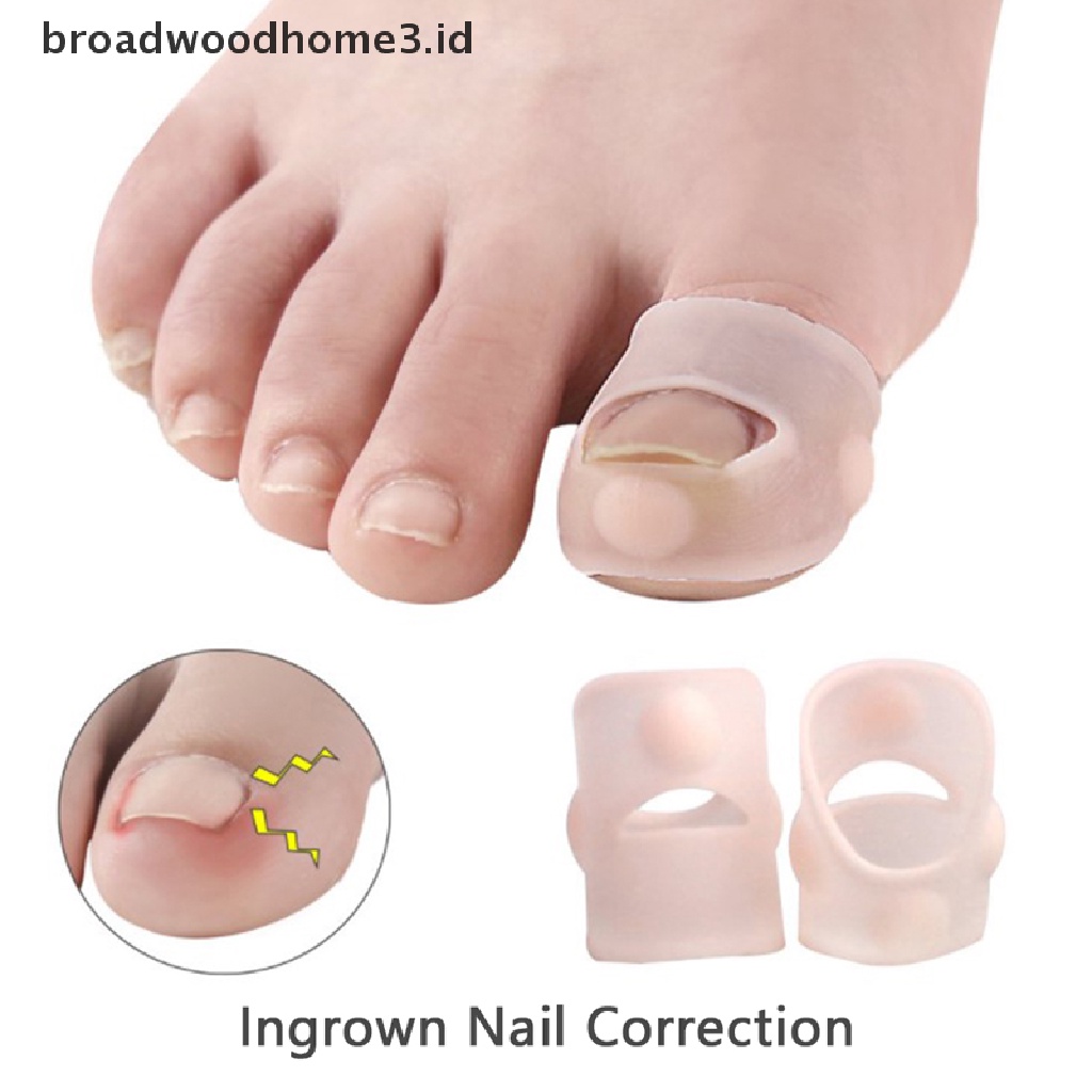 1 Pasang Alat Koreksi Kuku Kaki Ingrown Bahan Silikon