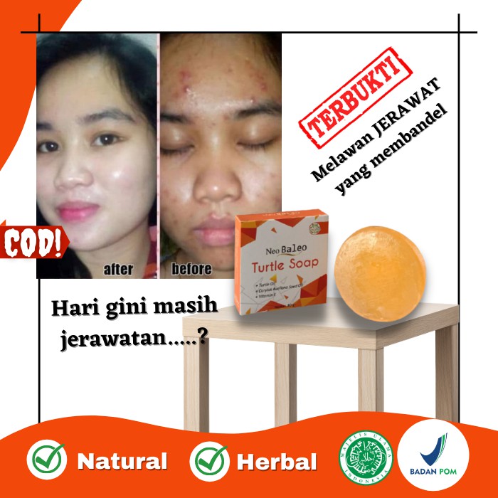 BS10 PAKET NEO Baleo TURTLE SOAP SABUN BULUSSABUN MUKA FACIAL FOAM skincare