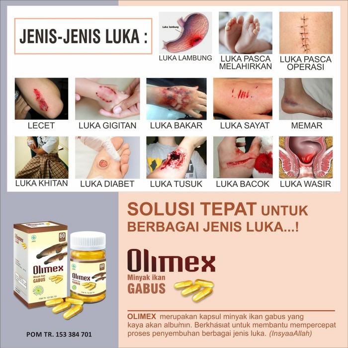 Olimex Albumex Minyak Ikan Gabus Isi 60 Kapsul Pengobatani Luka Diabetes Luka Infeksi Pada Lambung J Indonesia