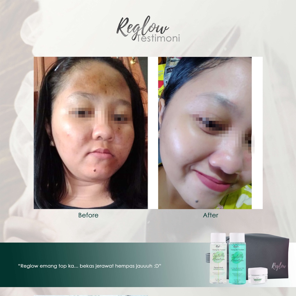 [1 PAKET] REGLOW GLOWING SERIES by dr Shindy Putri Skin Treatment Original BPOM - RE GLOW PAKET WHITENING & FLEK HITAM BERAT MENAHUN & ACNE JERAWAT BEKAS JERAWAT MS GLOW, JJ GLOW, ADORALY, BEAUTY IN THE POT, JUSTMINE dr sindy putri-3