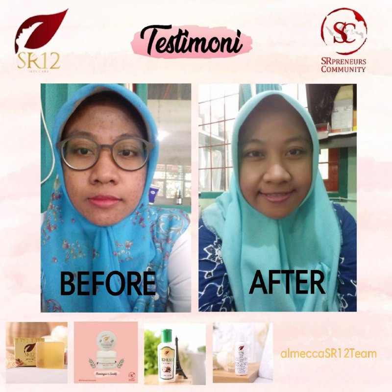 KEFIR ETAWA MASKER SR12  BPOM TERBAIK KULIT BERMINYAK &amp; SENSITIF / KEFIR MASK SUSU KAMBING ETAWA