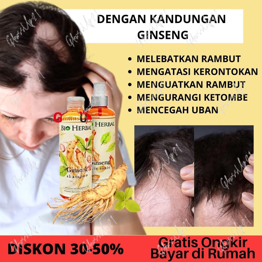 PENUMBUH RAMBUT KEBOTAKAN - SHAMPO PENUMBUH RAMBUT - BIO HERBAL GINSENG PAKET SHAMPO &amp; HAIR TONIC ORIGINAL