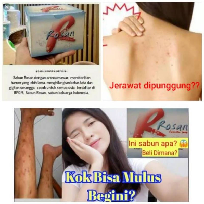 Sabun Rosan Beauty Kesehatan Kecantikan Glowing Anti Jerawat Alergi Aroma Mawar