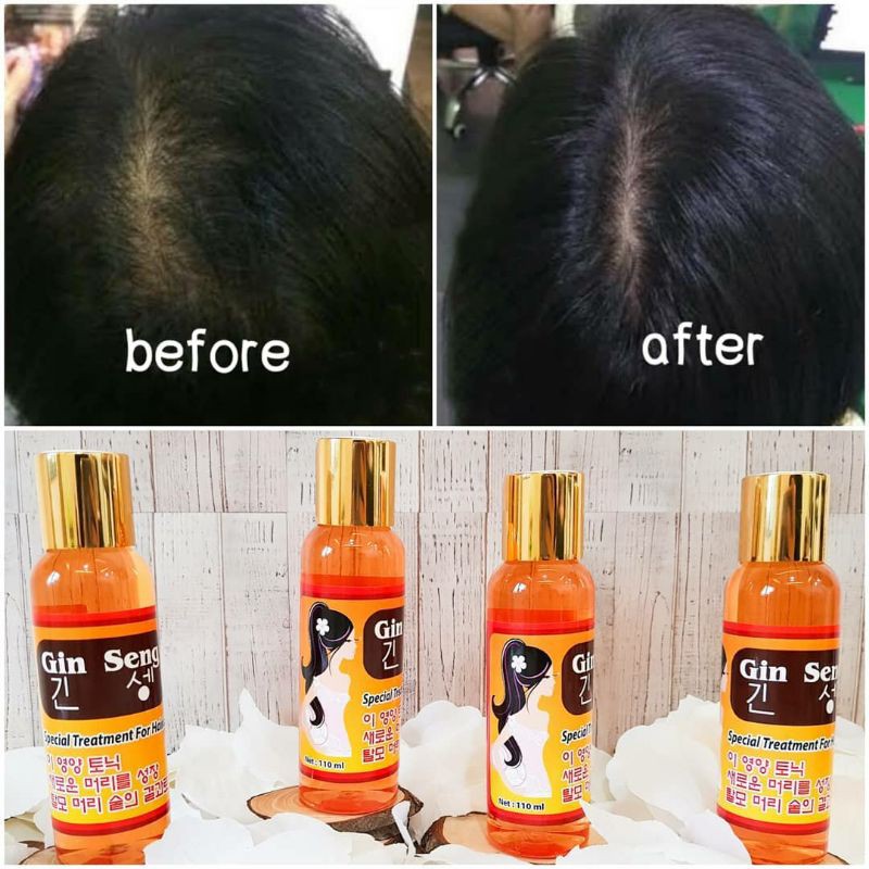 Hair Tonic Red Ginseng Korea Penumbuh Rambut