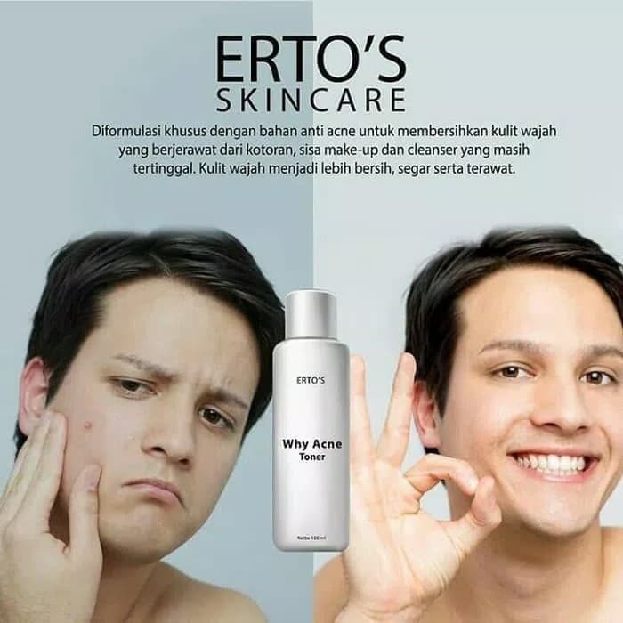 ERTOS WHY ACNE TONER - ERTO'S ACNE TONER JERAWAT ORIGINAL