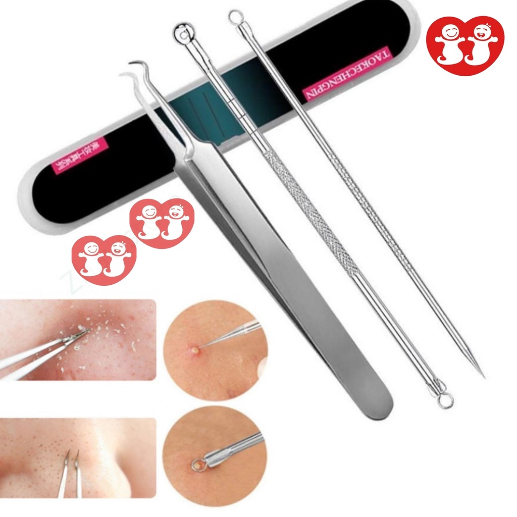 Set Alat Pencabut Komedo Pinset Jerawat Pembersih Blackhead Stainless