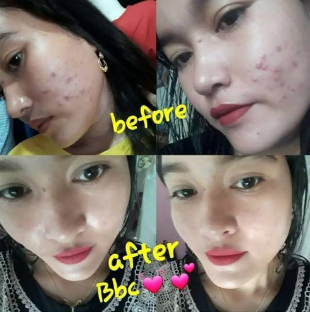 TESTI BBC beautycare