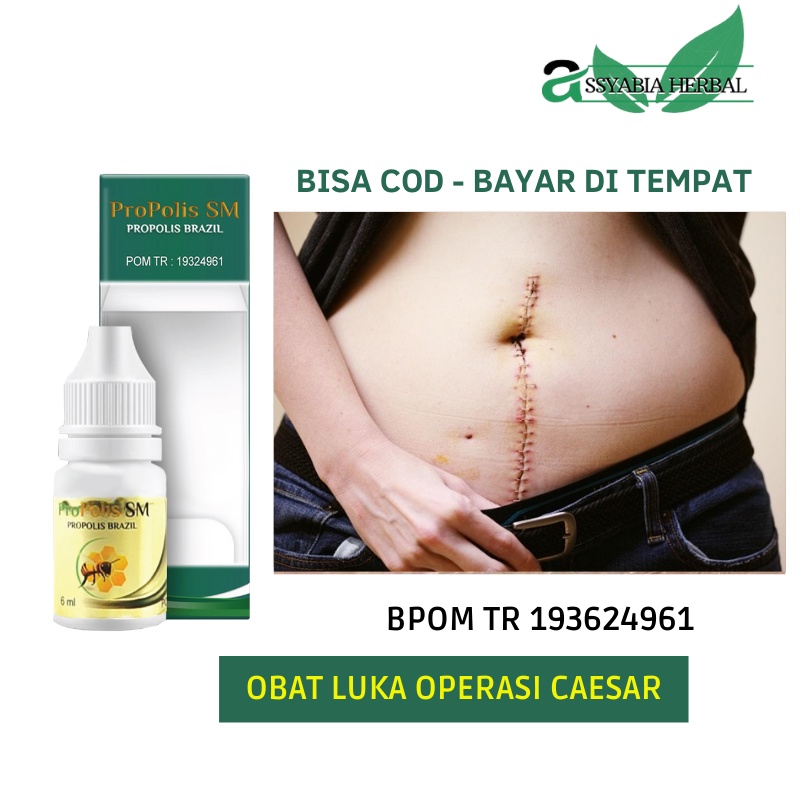 Obat Pengering Luka Pasca Operasi Caesar Jahitan Diabetes Luka Bakar Luka Koreng Luka Dalam PROPOLIS
