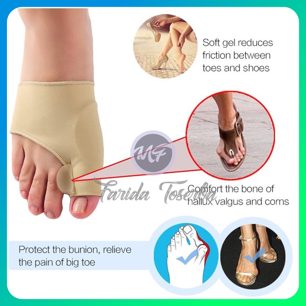 pelurusjempol kaki, hallux valgus. splint , bunion pad, night splint