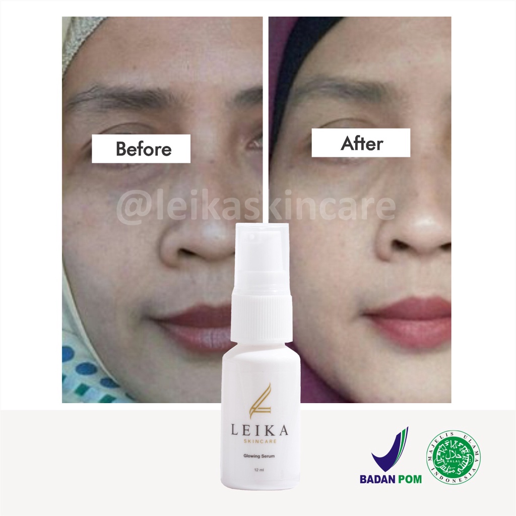 Ampuh! Pelembab Wajah untuk Kulit Wajah Kering dan Kusam Ampun BPOM Pelembab untuk Wajah Buat Kulit Normal Sensitif Glowing Serum Leika Skincare 12ml Asli HALAL MUI Resmi BPOM