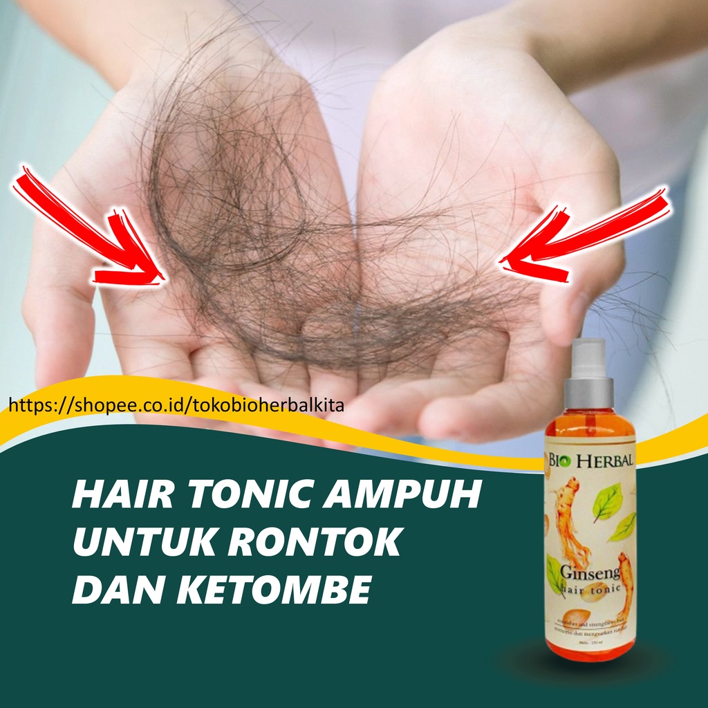 Obat Rambut Rontok Parah Hair Tonik Gingseng Pencegah Rambut Rontok Parah Rusak Dan Ketombe Penumbuh