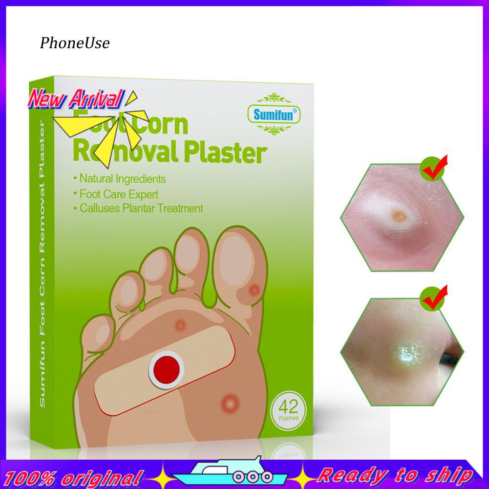 painful foot corn treatment