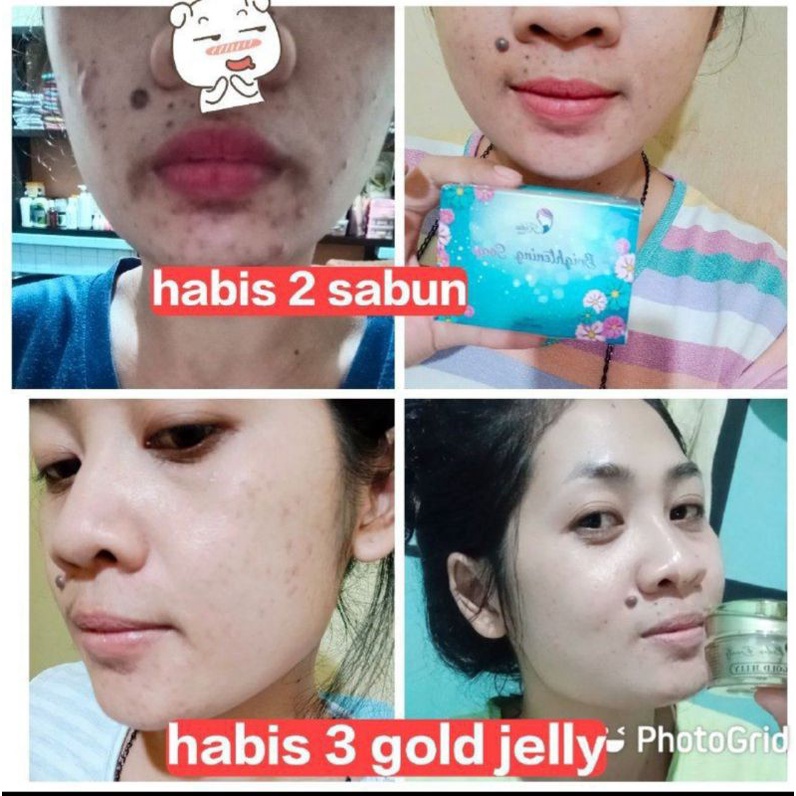PROMO‼️Gold Jelly 2 + Free Sabun Kedas Beauty  100% ORI BPOM Siang Malam Pemutih Wajah-6