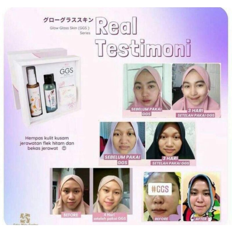 GGS SERIES GLOW GLASS SKIN SR12 HERBAL SKINCARE BPOM - KRIM GLOWING DALAM 1 MINGGU MENGHILANGKAN FLEK JERAWAT KRIM GLOWING KOREA PEMUTIH CEPAT ALAMI AMAN BPOM SKINCARE