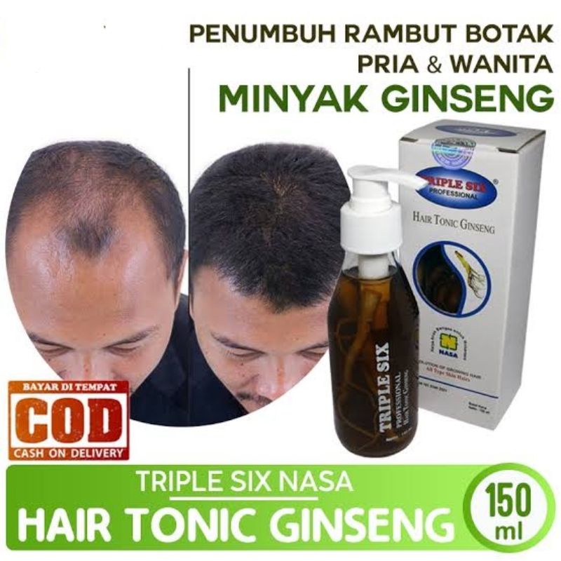 Obat Rambut Rontok Parah dan Penumbuh Rambut Botak Ampuh Herbal BPOM Mengurangi Ketombe Pria Wanita 